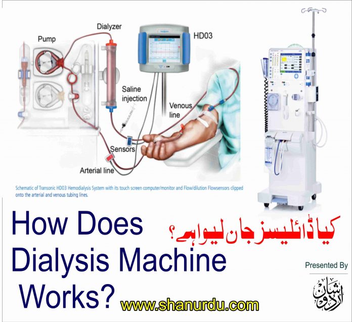 ڈائلیسزؔ|Dialysis